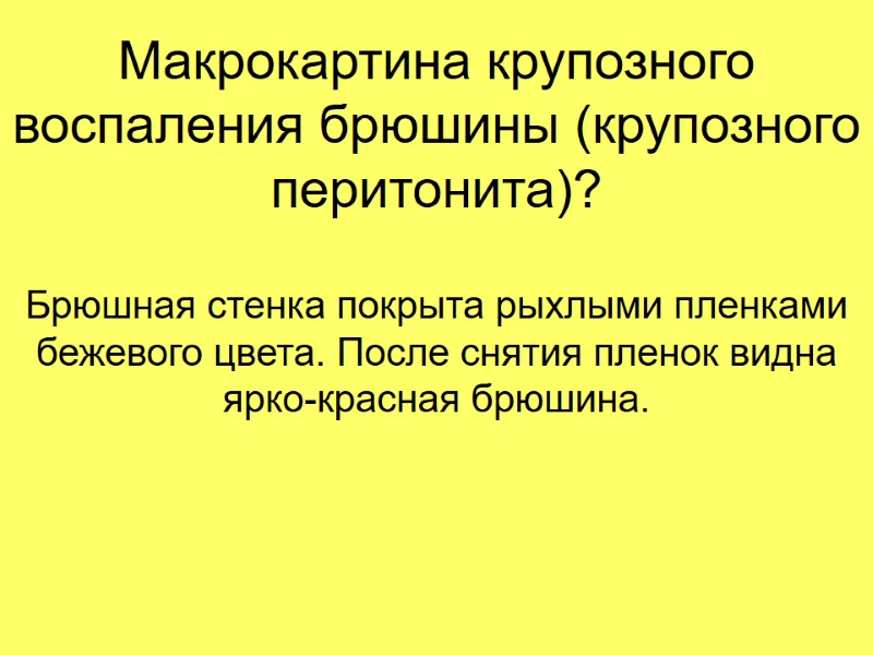 Макрокартина крупозного воспаления брюшины (крупозного перитонита)? Брюшная стенка покрыта рыхлыми пленками бежевого цвета. После Макрокартина крупозного воспаления брюшины (крупозного перитонита)? Брюшная стенка покрыта рыхлыми пленками бежевого цвета. После